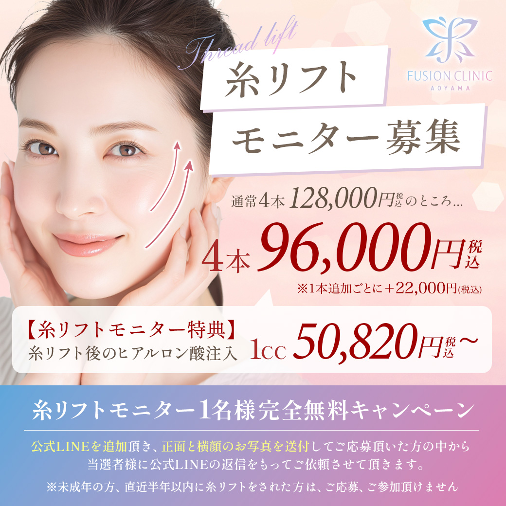 2月キャンペーンバナー