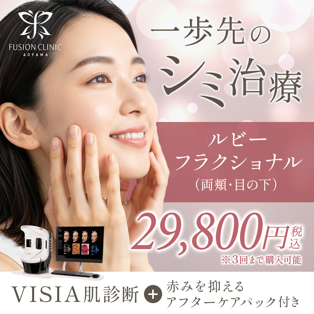 2月キャンペーンバナー