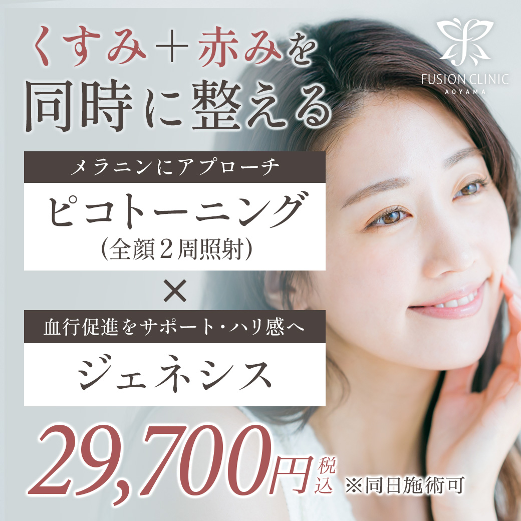 2月キャンペーンバナー