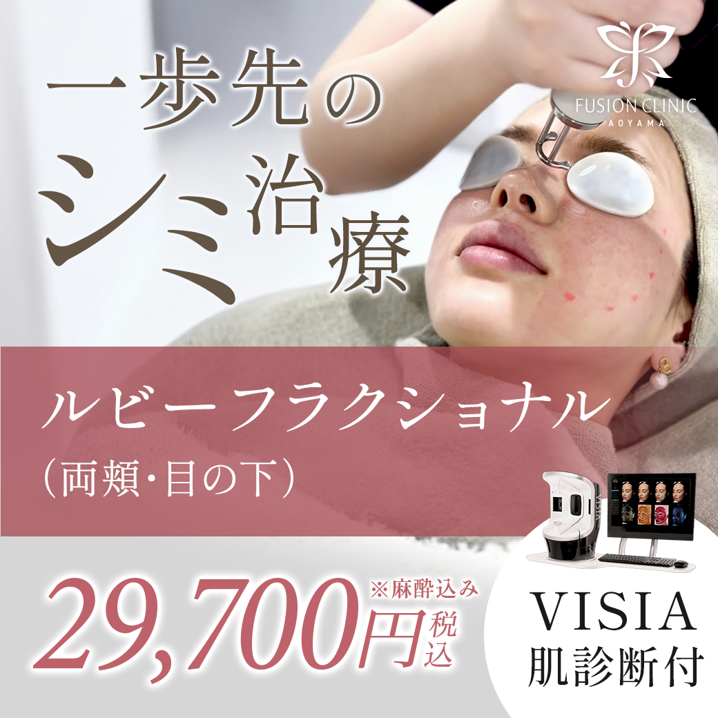 キャンペーンバナー